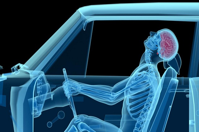 Accidentes de auto ¿Necesito tratamiento quiropráctico?